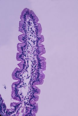 Figura 10. Vilosidade individualizada em aumento maior com aspecto digitiforme. As células epiteliais (enterócitos) são cilíndricas com núcleo em posição basal e se assentam na membrana basal. Células califormes produtoras de muco podem ser observadas ao longo das vilosidades (células esbranquiçadas arredondadas).