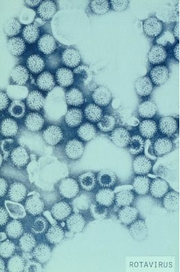 Figura 10- Ultramicrofotografia do Rotavirus. Sua designação se deve ao seu aspecto similar à uma roda denteada.