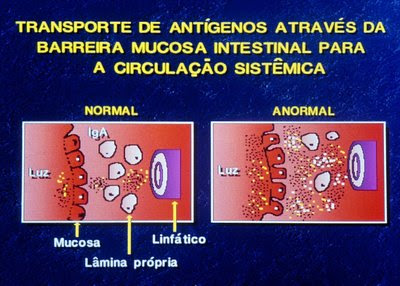 Figura 11. Exemplo gráfico do transporte de macromoléculas em situação normal e patológica, quando há fracasso de um ou mais mecanismos de constituição da barreira de permeabilidade intestinal.