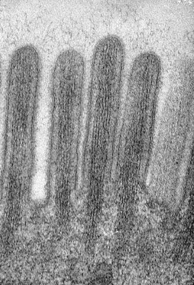 Figura 14. Material de biópsia do intestino delgado em microscopia eletrônica destacando as microvilosidades em maior aumento e as micromiofibrilas que delas emergem e que dão suporte ao muco produzido pelas células califormes.