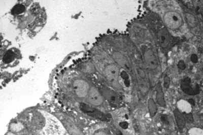 Figura 18. Material de biópsia de intestino delgado em microscopia óptica comum em grande aumento, corte semi-fino, mostrando colônias de Escherichia coli enteropatogênica firmemente aderidas à superfície mucosa provocando intensas alterações morfológicas no epitélio intestinal.