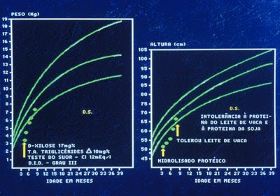 Figura 33. Gráfico pondero-estatural do paciente após tratamento dietético e recuperação clínica e nutricional.