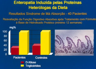 Figura 34. Comparação da avaliação da função digestivo-absortiva antes e após o tratamento em um grupo de pacientes portadores de Enteropatia Alérgica; notar também a recuperação da morfologia do intestino delgado evidenciando vilosidades digitiformes, dentro dos padrões da normalidade.