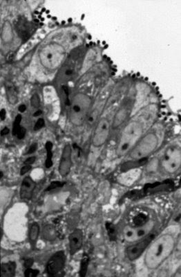 Figura 37. Material de biópsia do intestino delgado à microscopia óptica comum, corte semi-fino, evidenciando nichos de Escherichia coli aderidas à superfície epitelial do intestino delgado.
