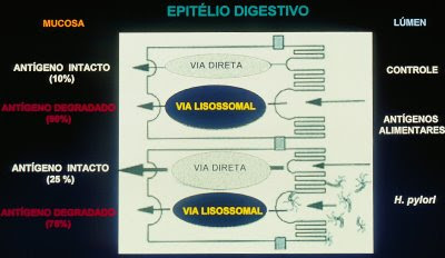 Figura 45. Esquema de lesão da mucosa gástrica provocada pelo Helicobacter pylori.