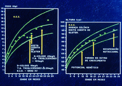 Figura 4- Observar o gráfico do crescimento pondero-estatural da paciente da Figura 3; há um importante agravo nutricional antes do diagnóstico e posterior recuperação após início do tratamento dietético apropriado. Testes de digestão (Sobrecarga com Triglicérides) e absorção (D-xilosemia) anormalmente alterados.