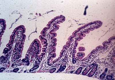 Figura 9. Material de biópsia de intestino delgado em microscopia óptica comum apresentando morfologia normal. As vilosidades são digitiformes e representam uma relação vilosidade: cripta 5/1. As células epiteliais são cilíndricas com núcleo em posição basal e o infiltrado linfo-plasmocitário encontra-se dentro dos limites da normalidade.