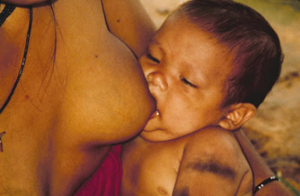 Figura 12- Lactente sorvendo o leite materno e excelente estado nutricional.