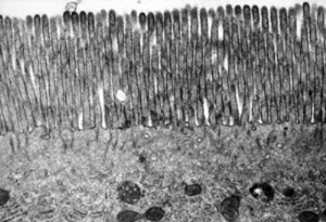 Figura 26- Material de biópsia do intestino delgado normal de rato. Trata-se de um enterócito em cuja porção apical visualiza-se a região das microvilosidades, e, já no interior do citoplasma podem ser vistas diversas organelas, tais como: mitocôndrias, retículos endoplasmáticos com seus ribossomos acoplados, bem como corpos multivesiculares.