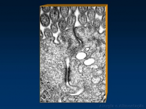 Figura 5- Ultramicrofotografia de dois enterócitos adjacentes evidenciando a região das microvilosidades no polo apical das células e o espaço intercelular mostrando em seu terço médio um desmosoma (mancha enegrecida).