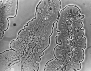 Figura 15- Microfotografia em microscópio de contraste de fase mostrando 2 vilosidades jejunais digitiformes aonde podem ser visualizadas as células epiteliais cilíndricas e as células califormes. Na superfície mais externa das vilosidades, na região das microvilosidades, nota-se um contorno enegrecido que corresponde à presença do produto de reação da HRP (macro-molécula proteica).