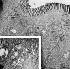 Figura 17- Ultramicrofotografia de um enterócito de uma preparação perfundida com DCh. O produto de reação da HRP (negro) encontra-se sobre as microvilosidades, as quais estão diminuidas em altura e ao longo do espaço intercelular. Notar no detalhe que as mitocôndrias (m) e o aparelho de Gogi (g) encontram-se inchados e deformados.