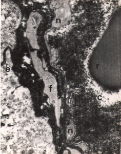 Figura 19- Ultramicrofotografia de uma preparação perfundida com Ch. Nota-se o produto de reação da HRP (negro) no interior de um capilar venoso da lâmina própria (c), desde o espaça intercelular (e). Notar em (r) uma hemácia e em (f) um fibroblasto