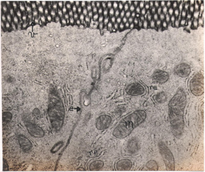 Figura 21- Ultramicrofotografia de 2 enterócitos adjacentes de uma preparação perfundida com TCh. O produto de reação da HRP (negro) encontra-se inteiramente confinado na região das microvilosidades (v). Notar que o espaço intercelular (e) encontra-se praticamente desprovido do produto de reação da HRP e que as mitocôndrias (m) e os retículos endoplásmicos (r) encontram-se totalmente intactos e preservados.