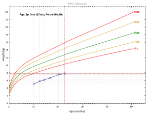 Gráfico 1- Evolução do gráfico ponderal do paciente antes e após a intervenção dietética.