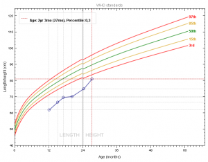 Gráfico 2- Evolução do gráfico de crescimento do paciente antes e após a intervenção dietética.