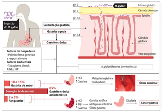 Gastrites Igastroped