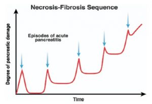 Figura 3- Conceito de necrose-fibrose para a lesão pancreática progressiva. Episódios repetidos de PA com necro-inflamação resultam em um aumento residual da injúria ao pâncreas, que a longo prazo acarretam dano irreversível à glândula, caracterizado por atrofia acinar e fibrose.