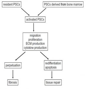 Figura 4- Propriedades das células estreladas (PSCs) pancreáticas. As PSCs são caracterizadas pelo conteúdo de gotas de lipídeos de vitamina A nos seus citoplasmas durante o estágio de quiescência e subsequente transformação no fenótipo ativado em respostas ao estresse oxidativo, etanol e seus metabolitos, e vários outros estímulos. Embora a origem das PSCs não esteja totalmente compreendida, algumas delas derivam da medula óssea. A persistente ativação das PSCs acarreta o surgimento da fibrose. Quando as PSCs são eliminadas por indução de apoptose ou por redirecionamento para o estágio quiescente, a evolução para fibrose poderia ser finalizada.