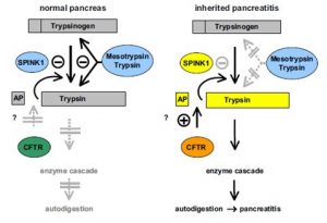 Figura 6- Modelo da pancreatite hereditária. No pâncreas normal (esquerda) a tripsina que é prematuramente ativada no interior do pâncreas é inibida pelo SPINK1, e, em uma segunda linha pela tripsina e pela mesotripsina, o que previne sua autodigestão. Na pancreatite hereditária (direita), mutações no PRESS1 ou no SPINK1 acarretam um desequilíbrio das proteases e suas inibidoras, resultando em autodigestão. O papel do CFTR é pouco conhecido.