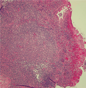 Figura 1- Visão de uma placa de Peyer em microscopia óptica comum, médio aumento, localizada na lâmina própria da mucosa ileal.