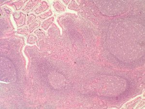 Figura 5- Visão à microscopia óptica comum em aumento médio de vários nódulos linfoides localizados na lâmina própria da mucosa ileal.