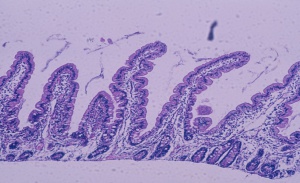 Figura 2- Aspecto morfológico da mucosa do intestino delgado normal: vilosidades digitiformes, enterócitos cilíndricos com núcleo em posição basal e glândulas crípticas normais. Relação vilosidade/cripta 5:1.