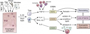 Figura 1- Visão geral da fisiopatologia da EEo. Fatores ambientais, incluindo alimentos e o microbioma, interagem com o epitélio esofágico para provocar a produção de citocinas pró-atopias IL-33 e TSLP. Células T reguladoras e células T helper tipo 2 secretam citocinas bioativas incluindo TGF-b, IL-4, IL-13 e IL-5, as quais provocam ruptura da barreira de permeabilidade, remodelação tecidual e inflamação eosinofílica.