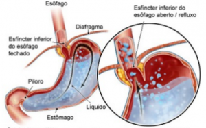 Figura 10