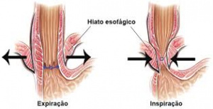 Figura 3- Diferentes situações do EEI de acordo com a respiração.