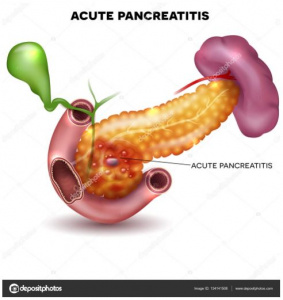 Figura 2- Representação esquemática da lesão inflamatória da PA.