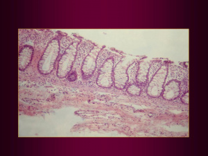 Figura 13- - Microfotografia em microscopia óptica comum da mucosa colônica evidenciando restituição morfológica após tratamento com fórmula à base de hidrolisado proteico.