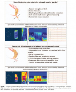 Figura - 1