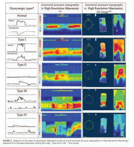 Figura - 2